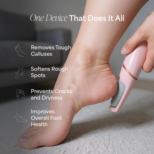 Velumi™ Callus Remover