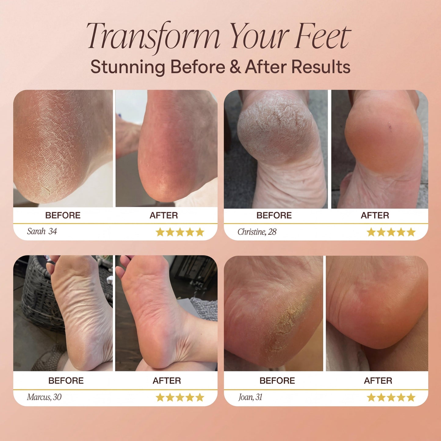 Velumi™ Callus Remover